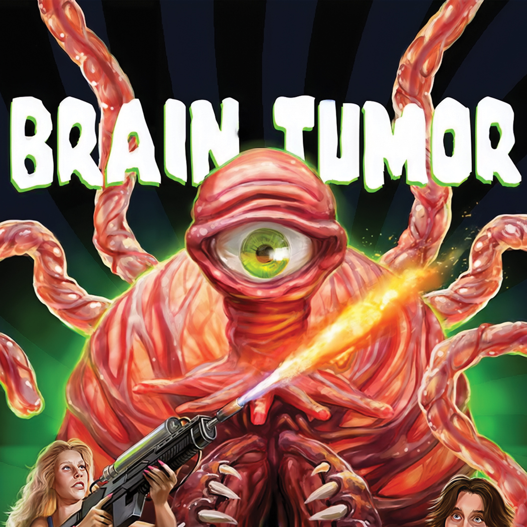 Brain Tumor