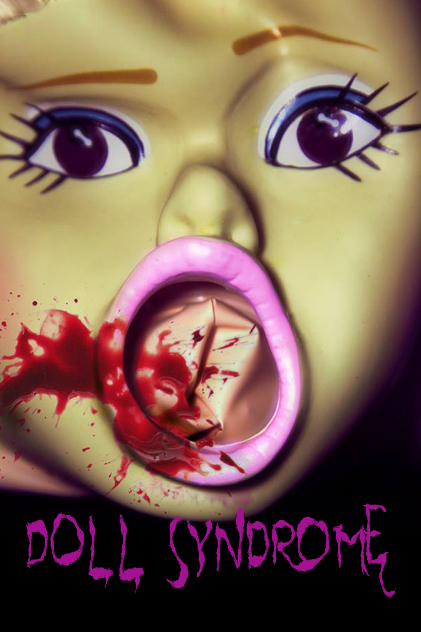 Doll Syndrome