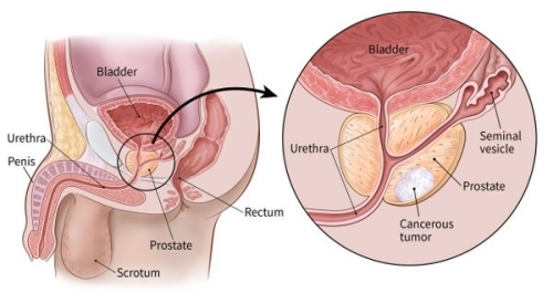 A Holistic Approach to the Prostate