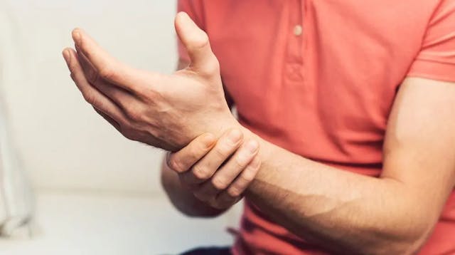 Carpal Tunnel Syndrome