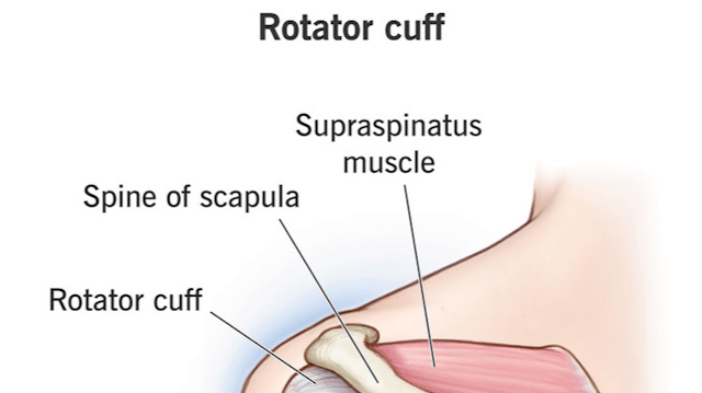 Targeted Therapy Rotator Cuff