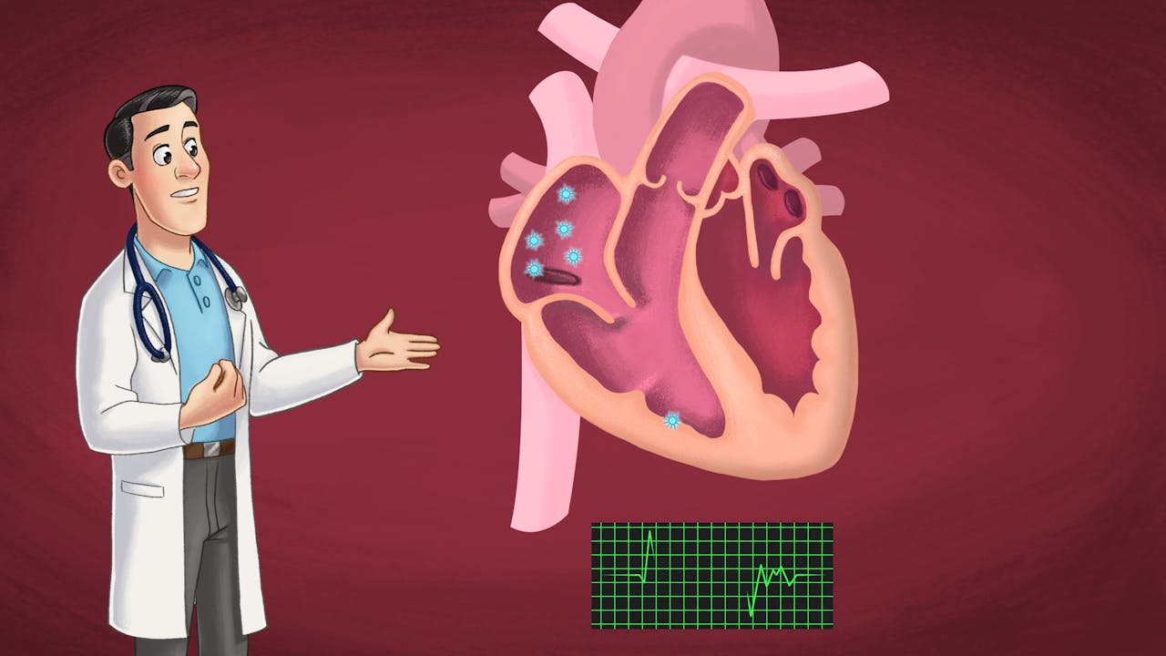 Atrial fibrillation