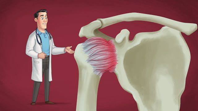 Frozen shoulder - Learn more