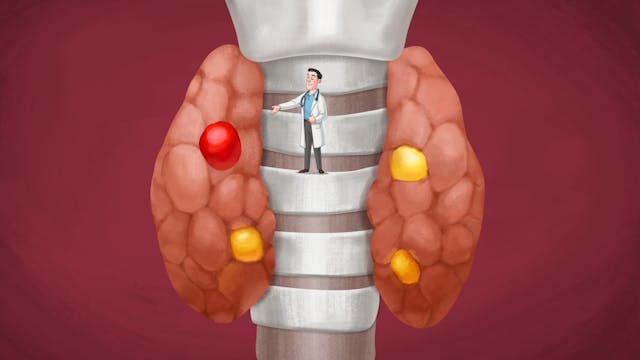 Hyperparathyroidism