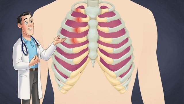 Costochondritis - Learn more