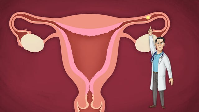 Ectopic pregnancy - Learn more