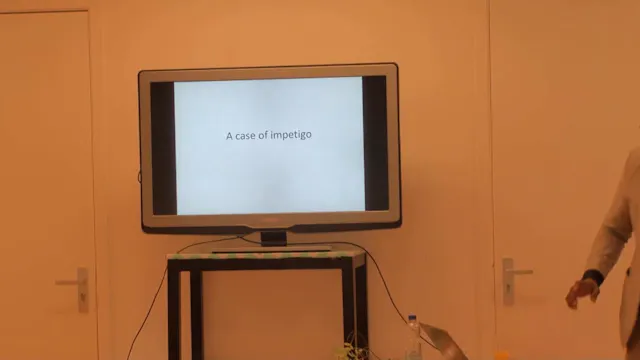 Veneeth course I – Part 9 A boy with impetigo