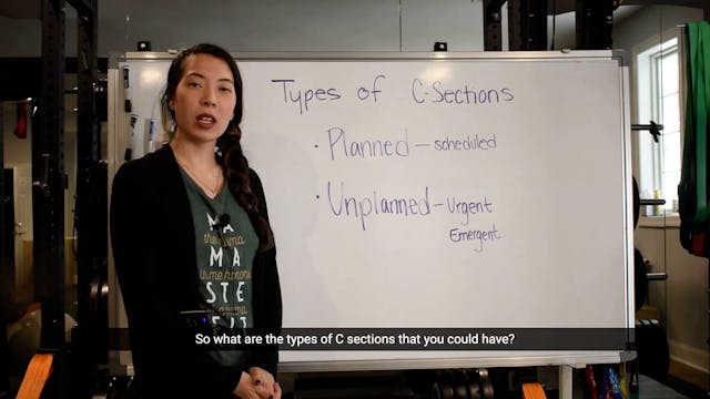 2 - Types of C-Sections