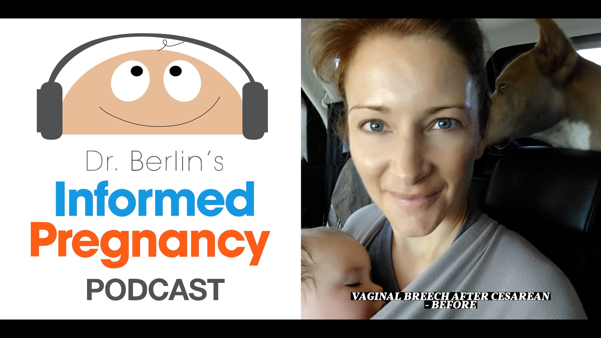 Ep. 64 Vaginal BREECH After Cesarean - BEFORE