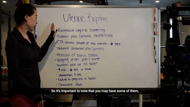 4- Uterine Rupture Signs