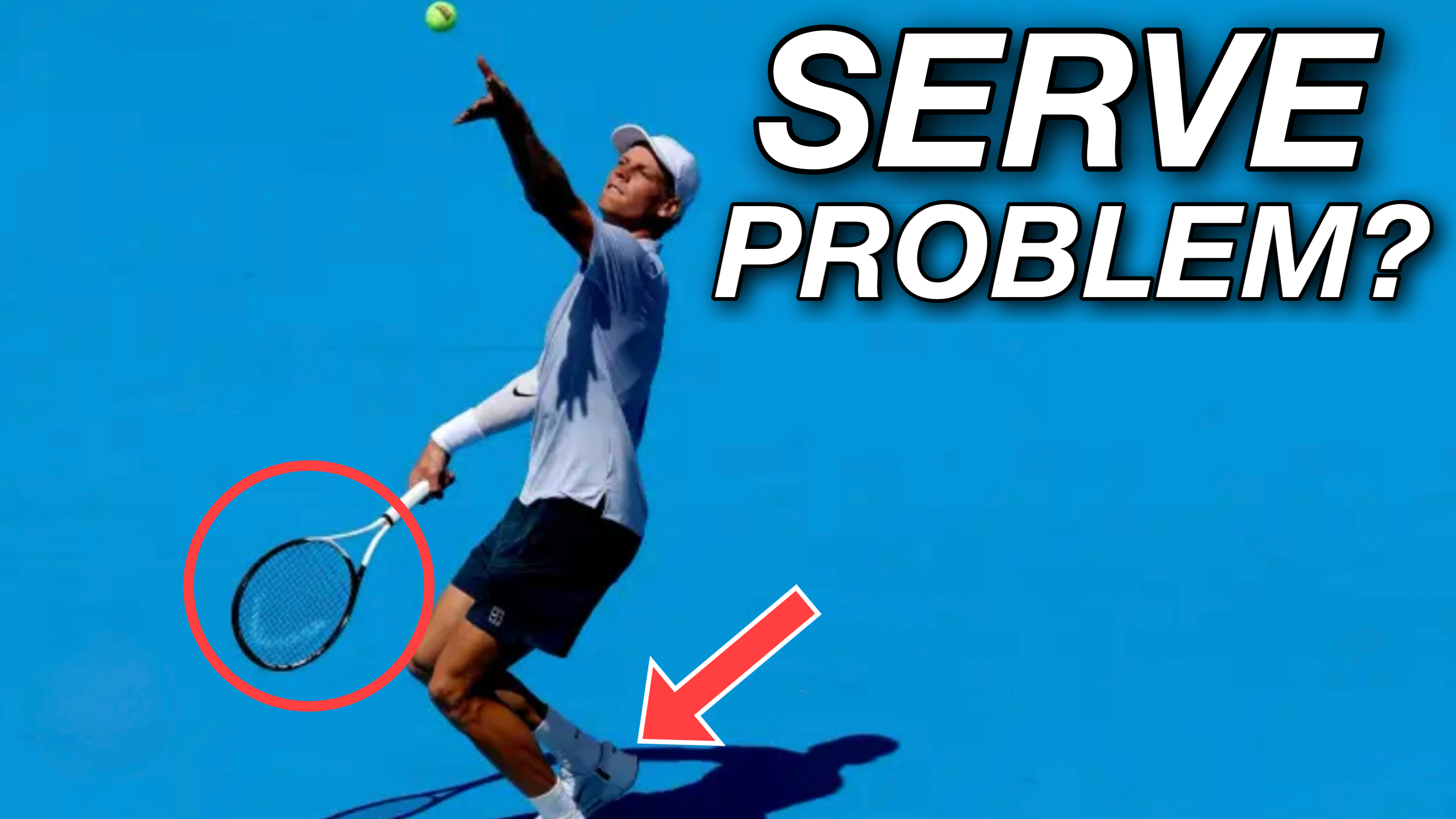 Does Sinner Have a Serve Problem?