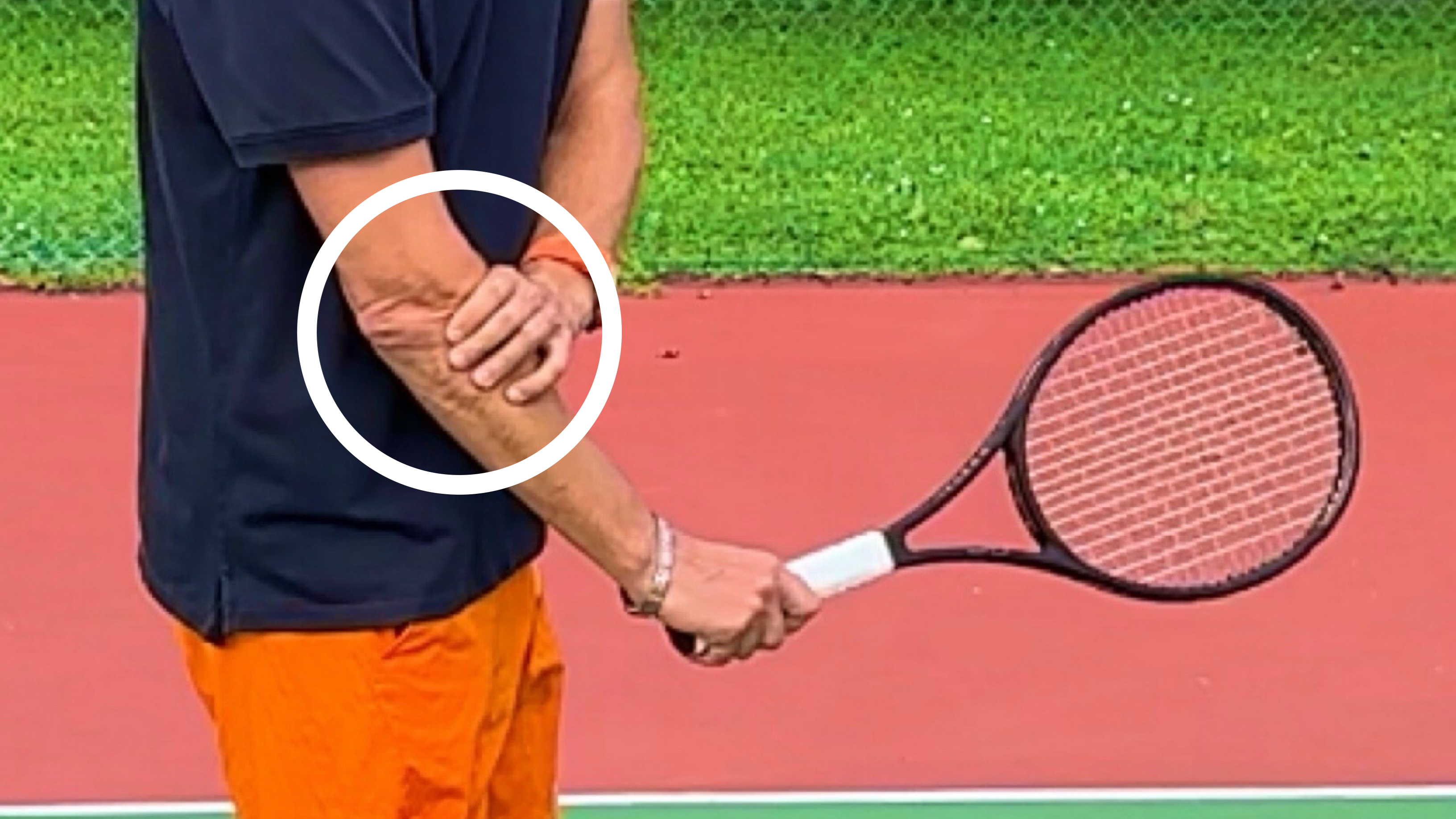 Tennis Elbow
