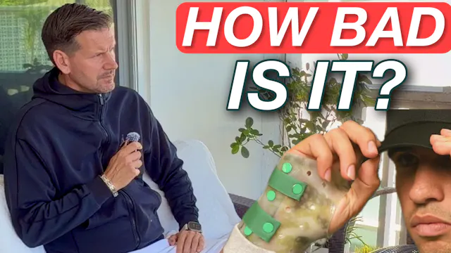 How Bad is the Alcaraz Wrist Injury?