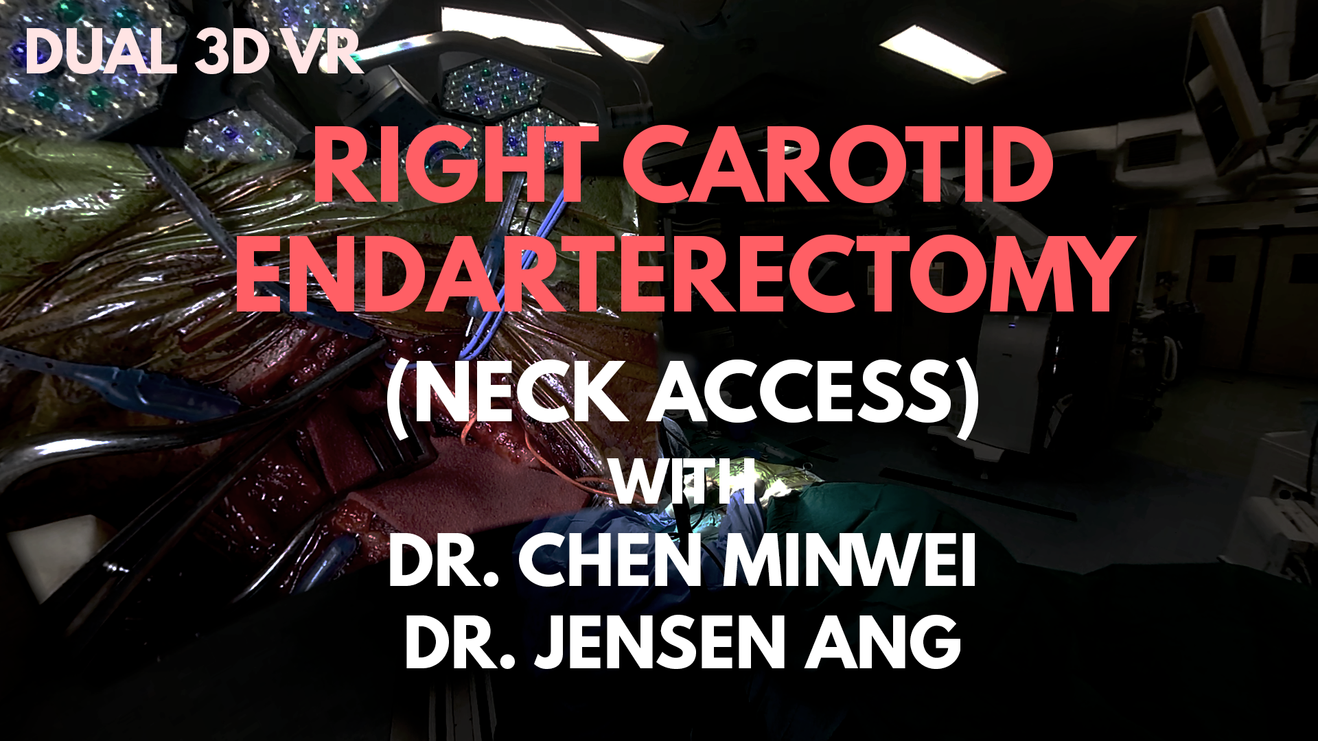 Tissue Dissection: Carotid Endarterectomy