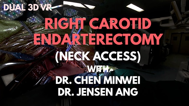 Tissue Dissection: Carotid Endarterectomy