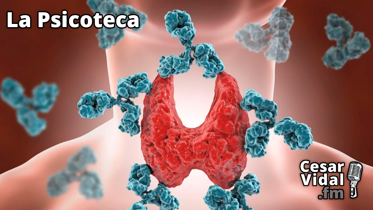 Hipotiroidismo, Diabetes, VIH y Neurosarcoidosis - 03/04/24