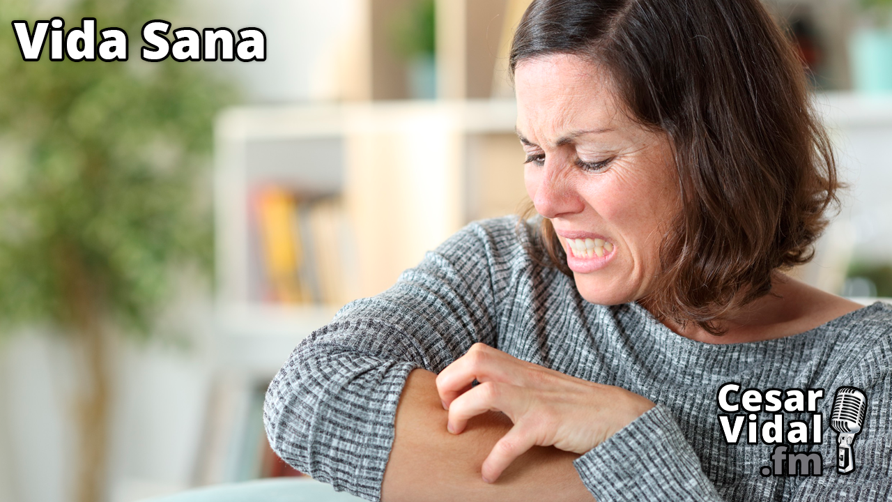 Psoriasis: Tratamiento natural - 26/04/23