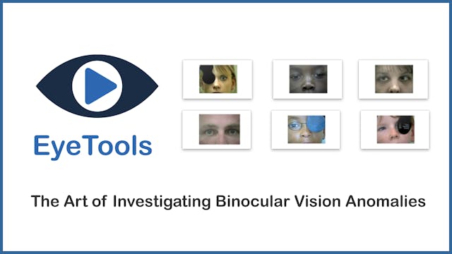 Art of Investigating Binocular Vision Anomalies