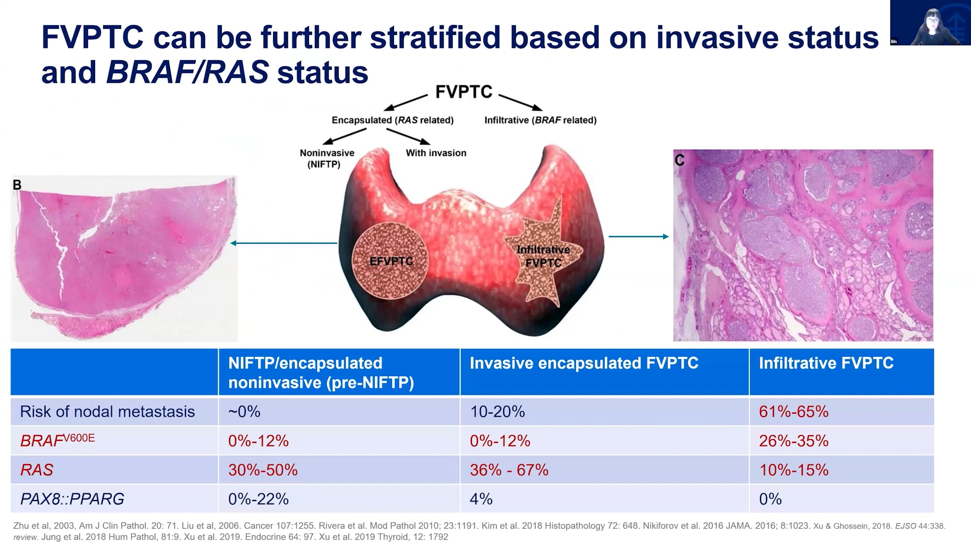 Day 2 Session 3 - Dr Bin Xu - Molecular Pathology of thyroid cancer