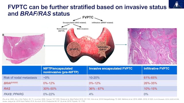 Day 2 Session 3 - Dr Bin Xu - Molecular Pathology of thyroid cancer