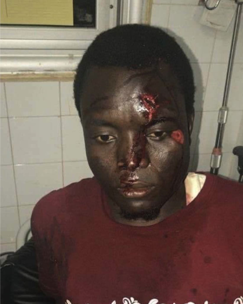 Crimes contre l’humanité au Sénégal