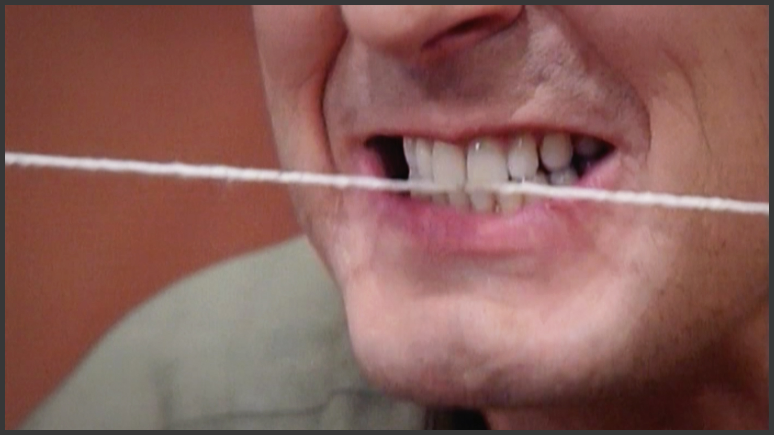 Never the Twine Shall Meet