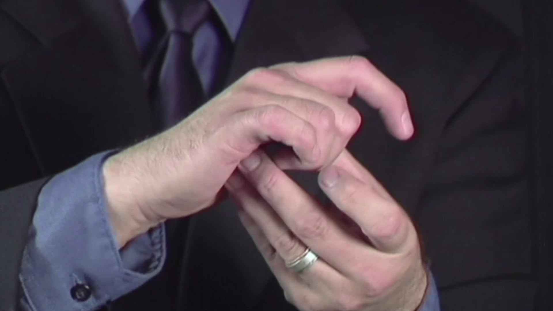 New Change-Over Palm 