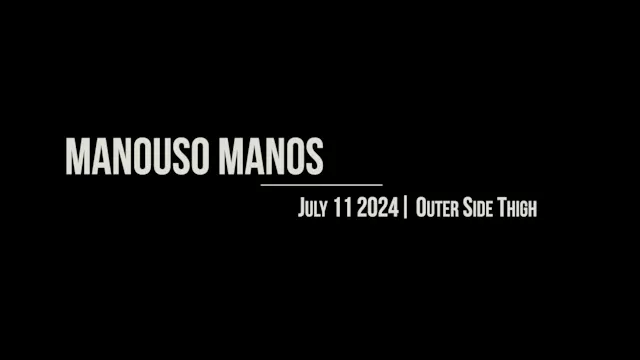 Manouso Manos July 11 2024 - outer side thigh