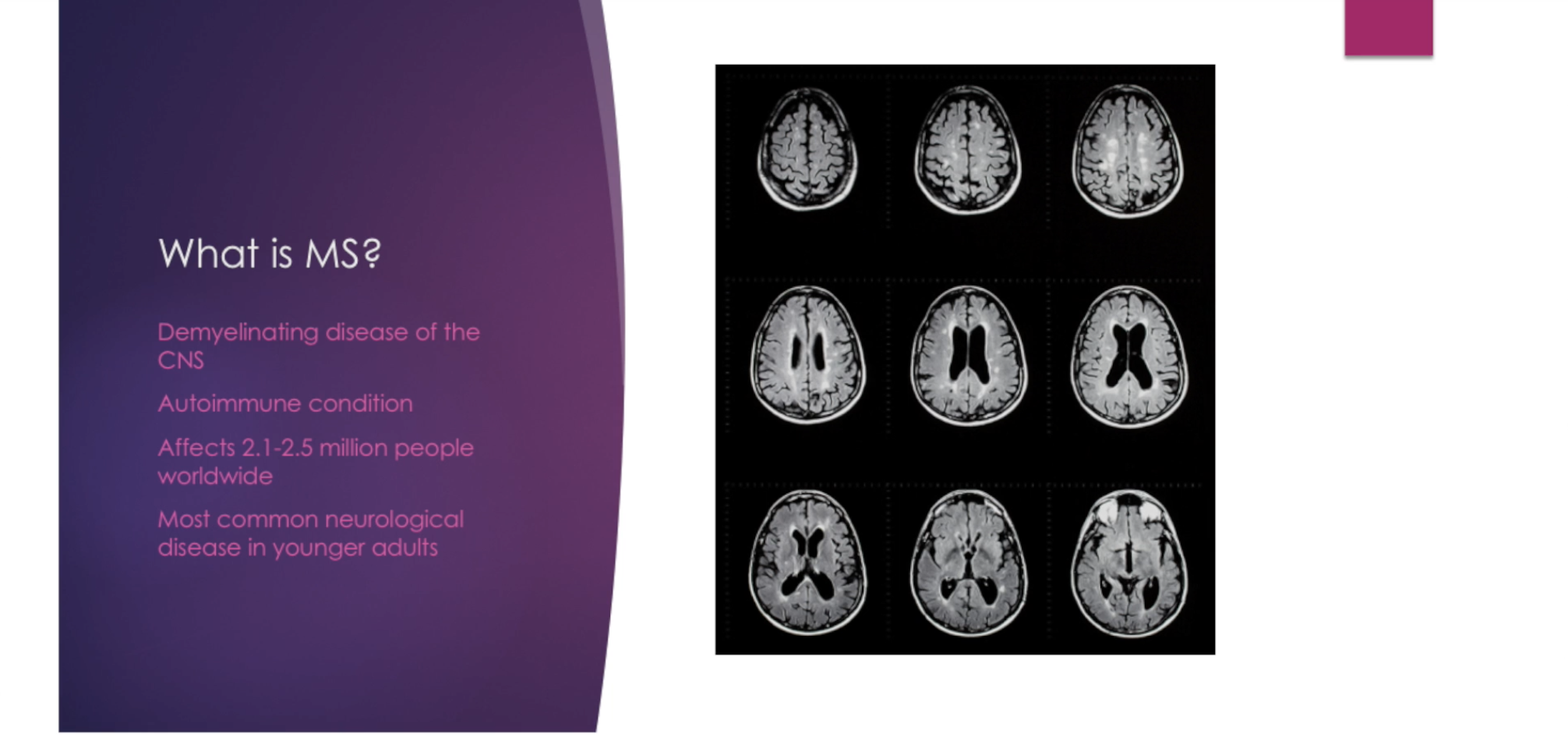 Understanding MS Workshop Introduction