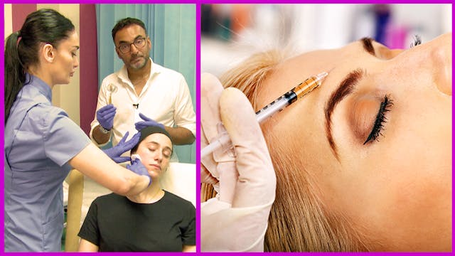 Microneedling – Collagen Induction Therapy