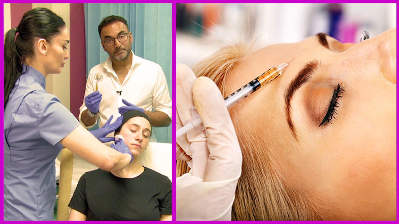 Microneedling – Collagen Induction Therapy