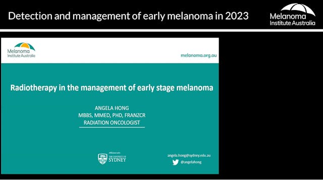 The role of radiotherapy in early mel...