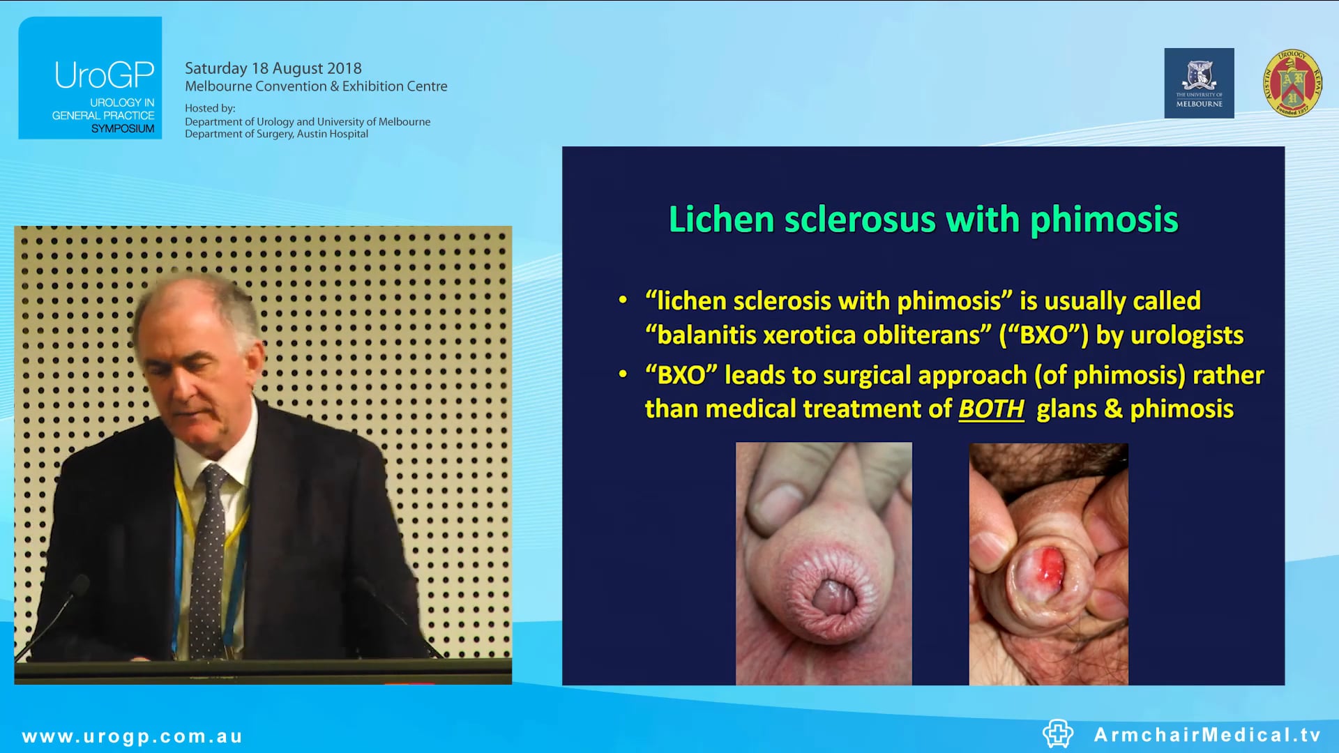 Genital dermatology - beyond STDs Assoc Prof Anthony Hall Tony Hall