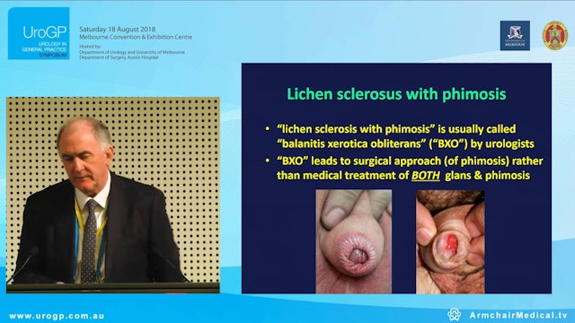 Genital dermatology - beyond STDs Assoc Prof Anthony Hall Tony Hall