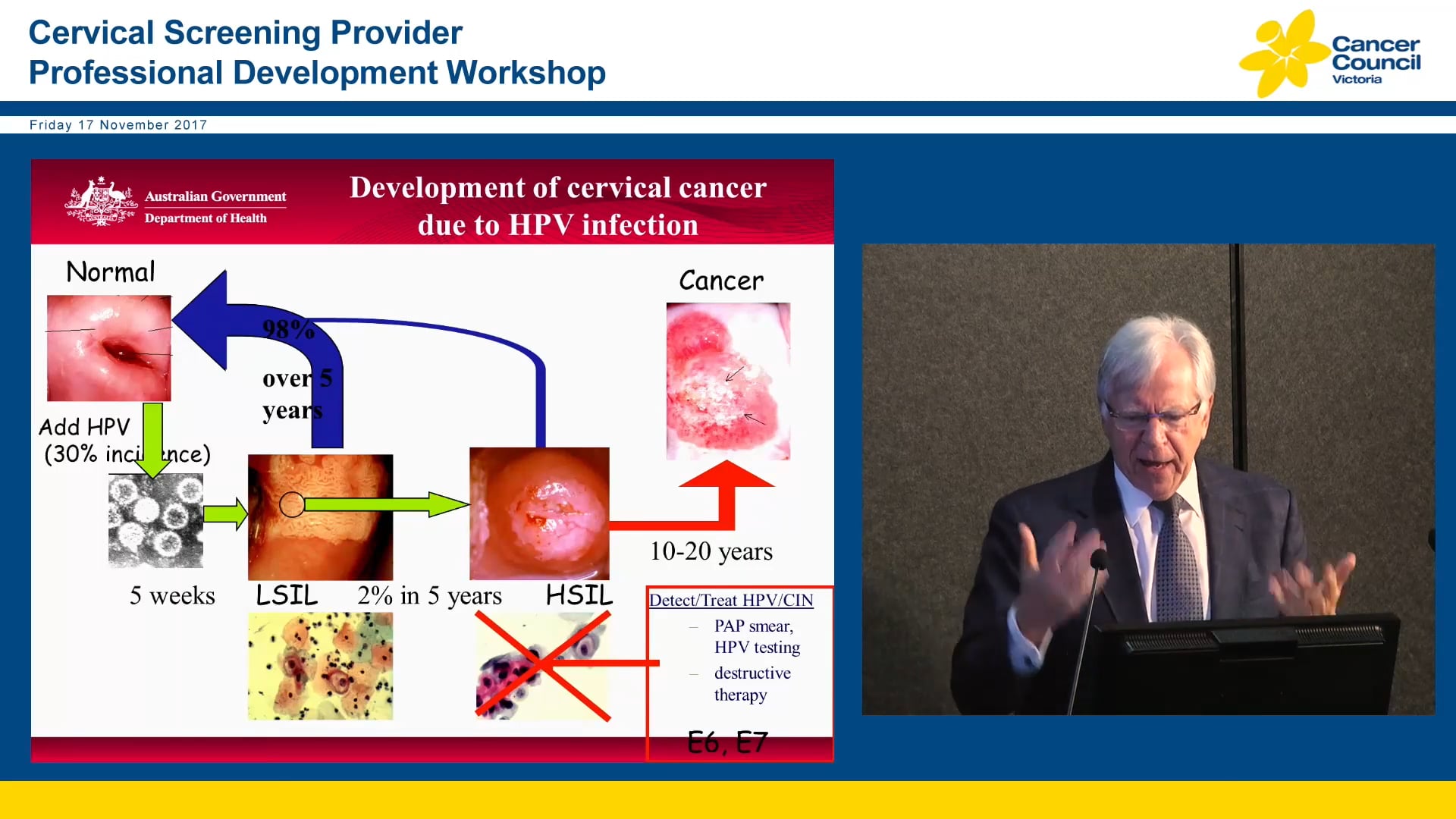 The Renewed National Cervical Screening Program - The Big Picture Prof Ian Hammond