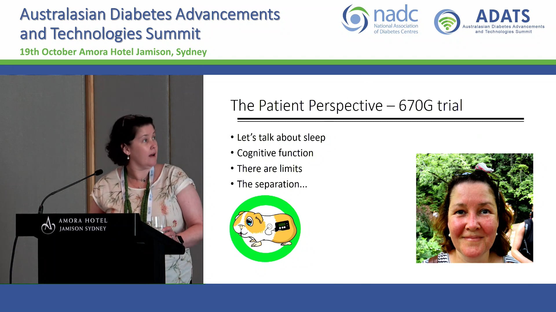 Automated insulin delivery in type 1 Diabetes The Patient Perspective Leanne Foster