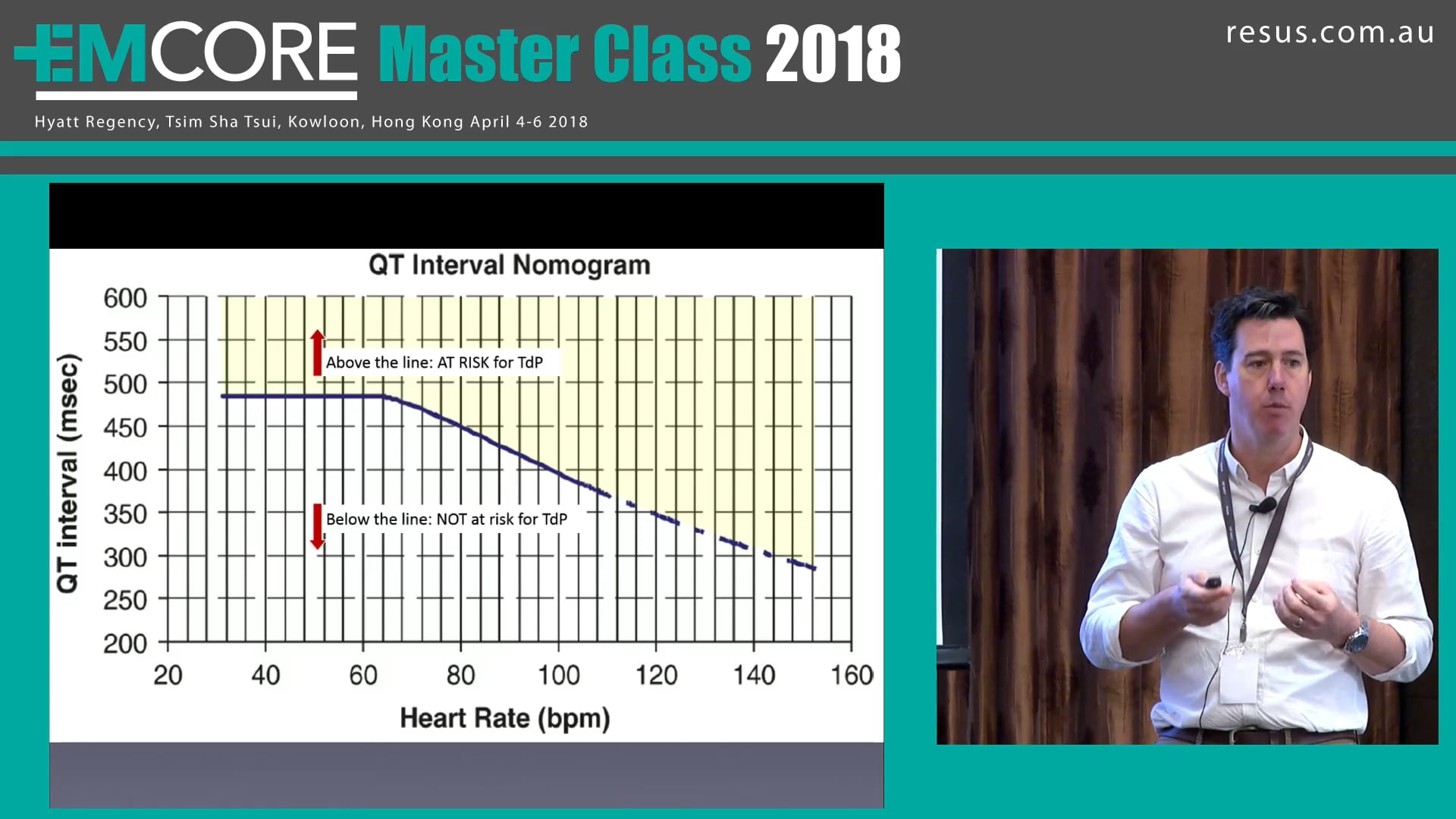 Deadly Arrhythmias Don't miss these Dr James Edwards