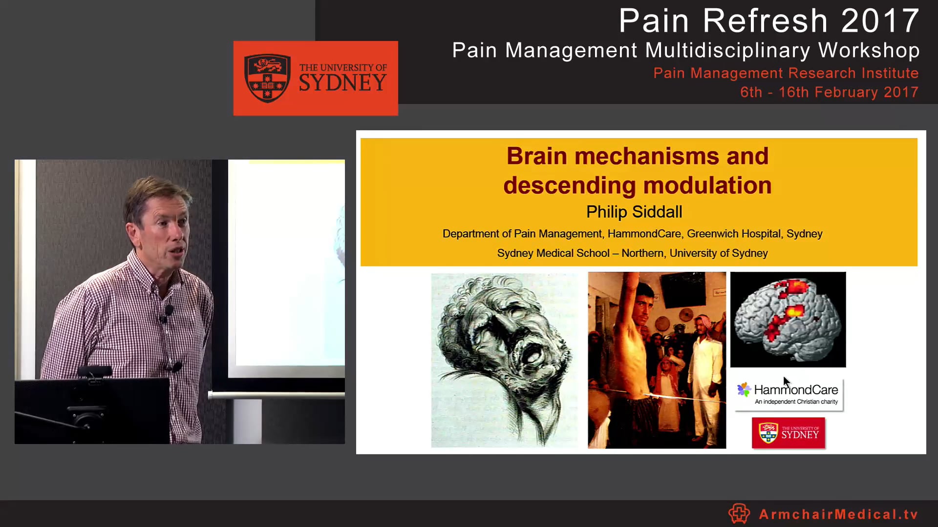 Brain mechanisms and descending modulation Professor Philip Siddall