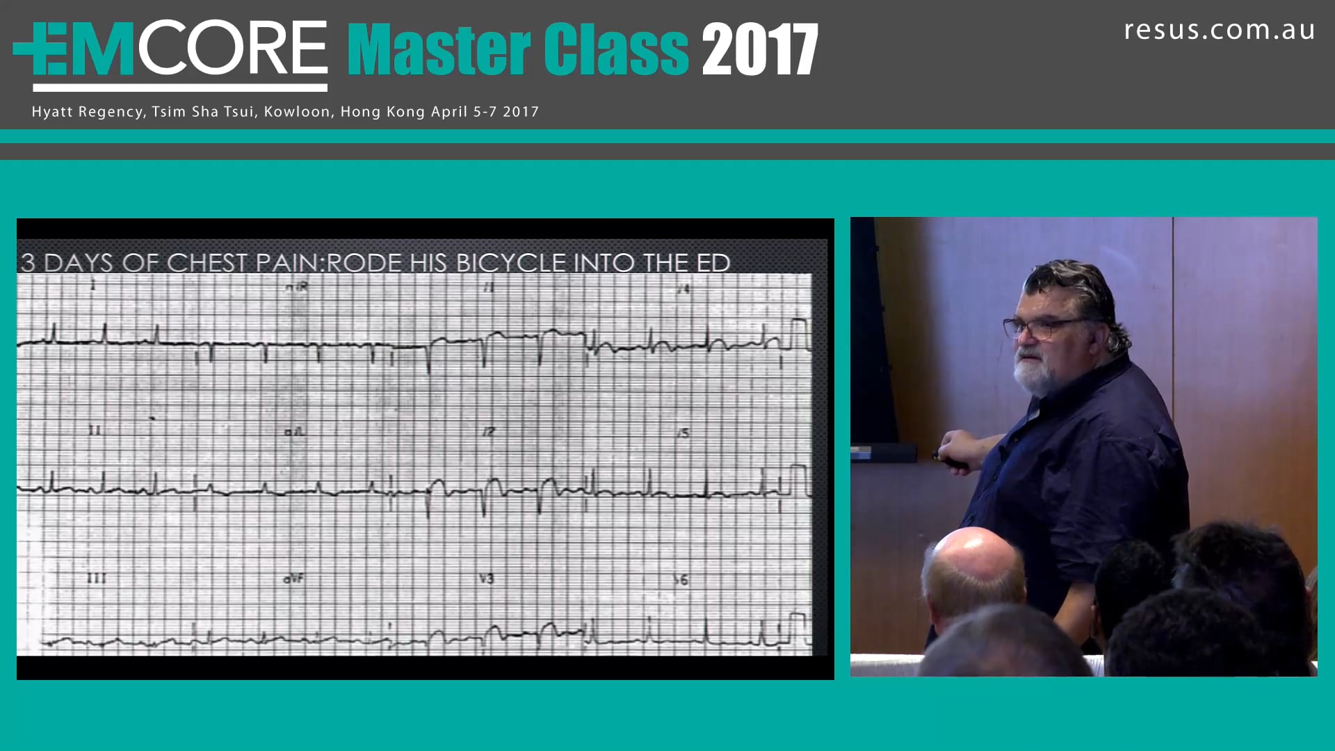 Ischaemia in ECG Assoc Prof Peter Kas