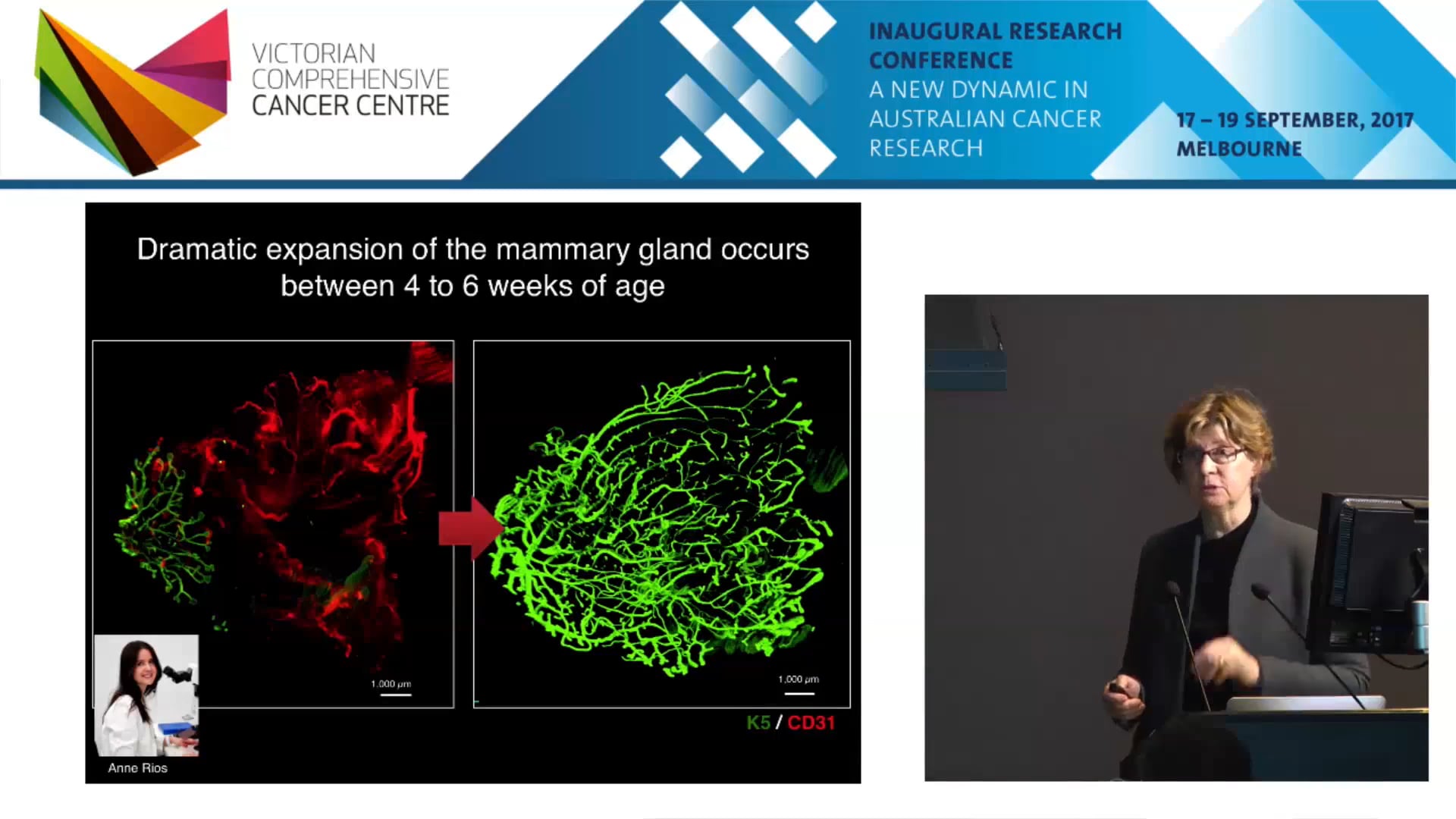 Identifying cells of origin of breast cancer - Jane Visvader