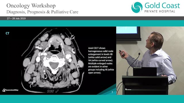 Imaging in oncology for General Pract...