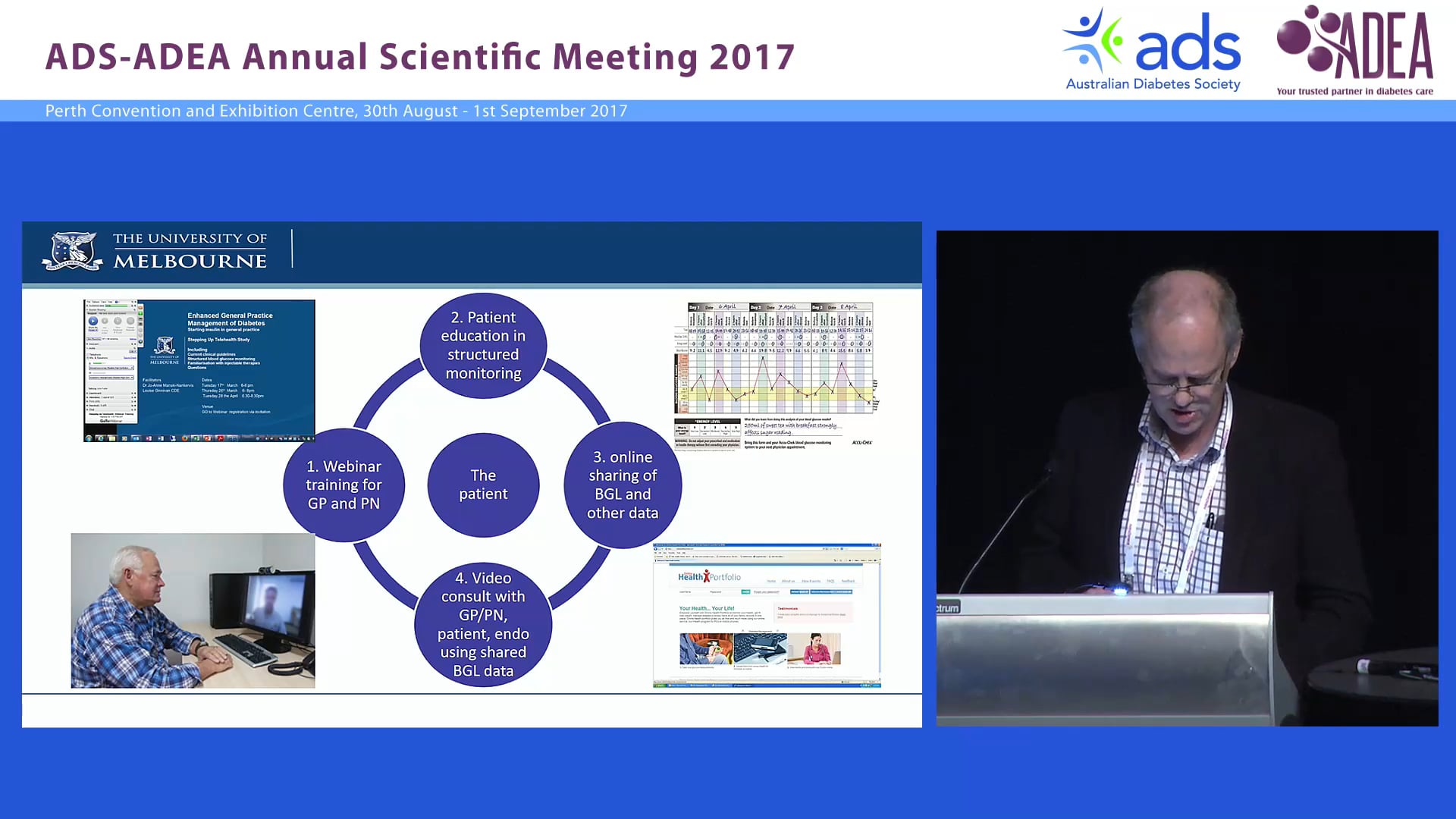 The future is now - technologies changing diabetes care Prof John Furler