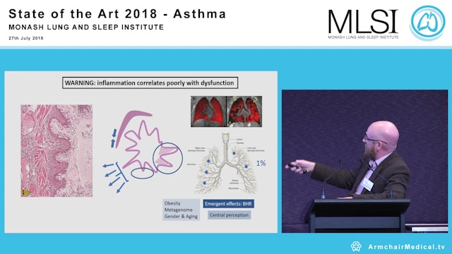 Asthma immuno-pathophysiology Professor Gary Anderson