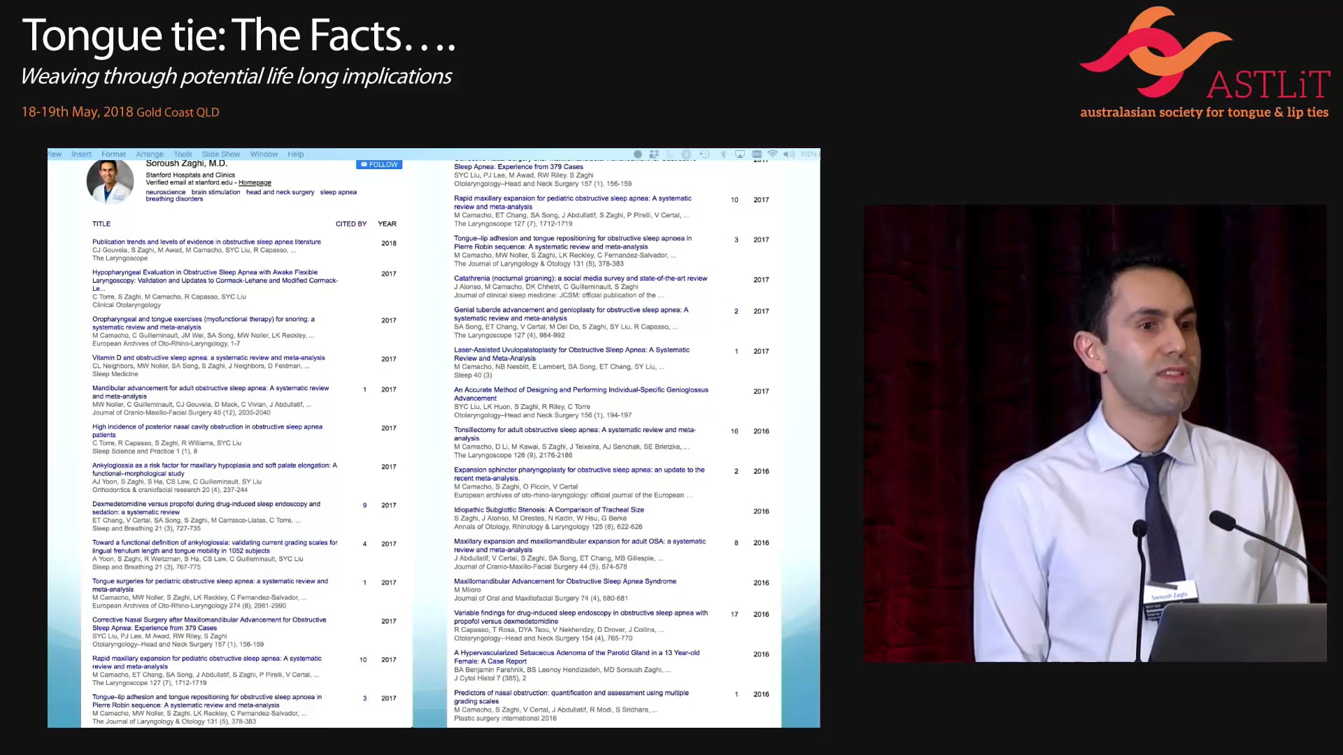 Pediatric Sleep Disordered Breathing and Maxillofacial Development Soroush Zaghi