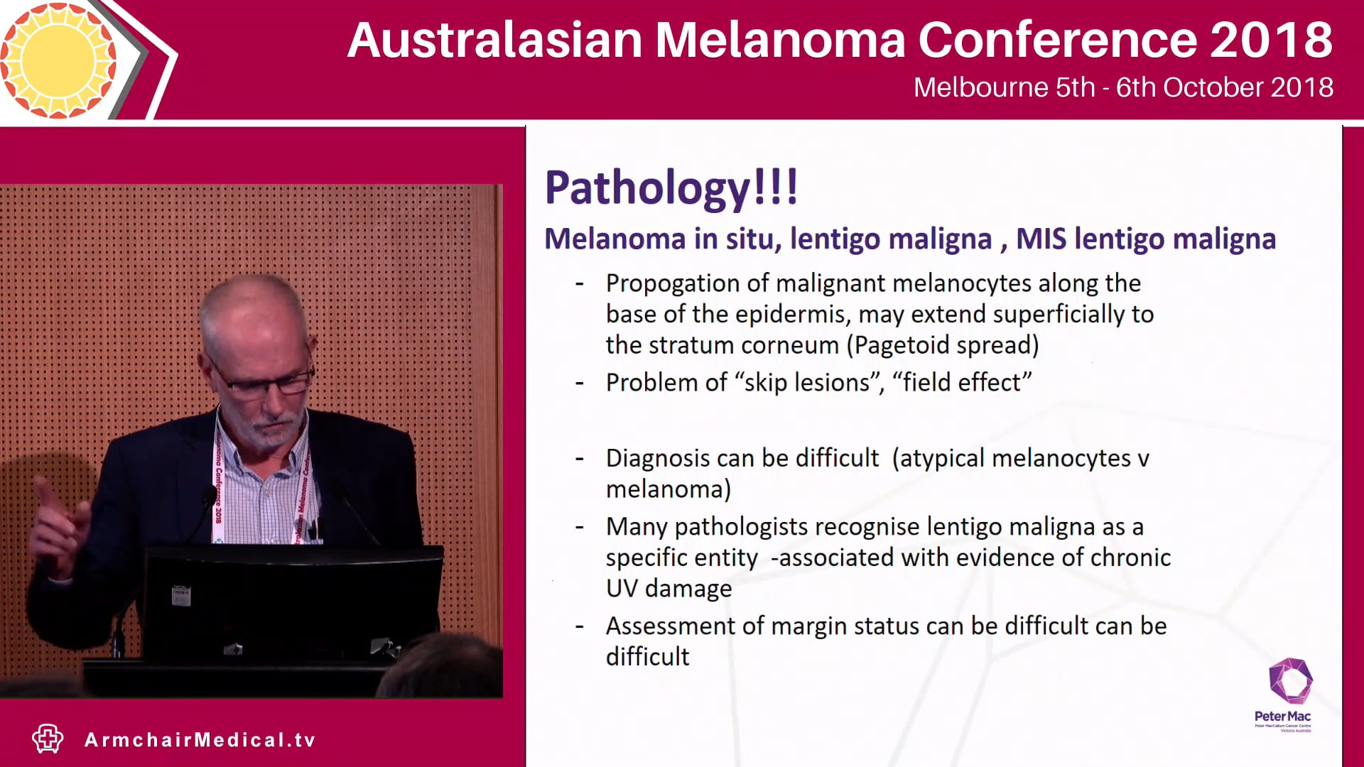 Challenges of special subtypes of melanoma - ALM, desmoplastic, neurotropic, extensive LM Michael Henderson