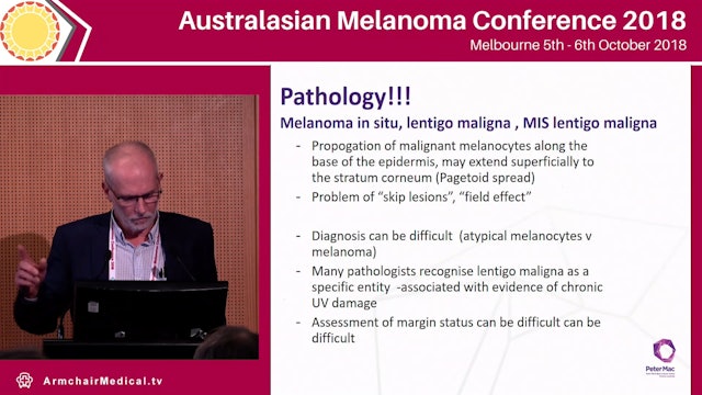 Challenges of special subtypes of melanoma - ALM, desmoplastic, neurotropic, extensive LM Michael Henderson