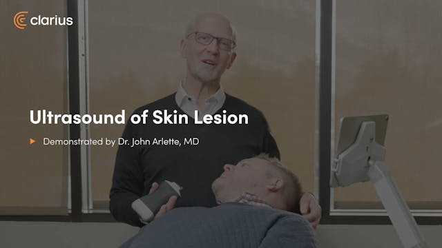 Ultrasound of Skin Lesion