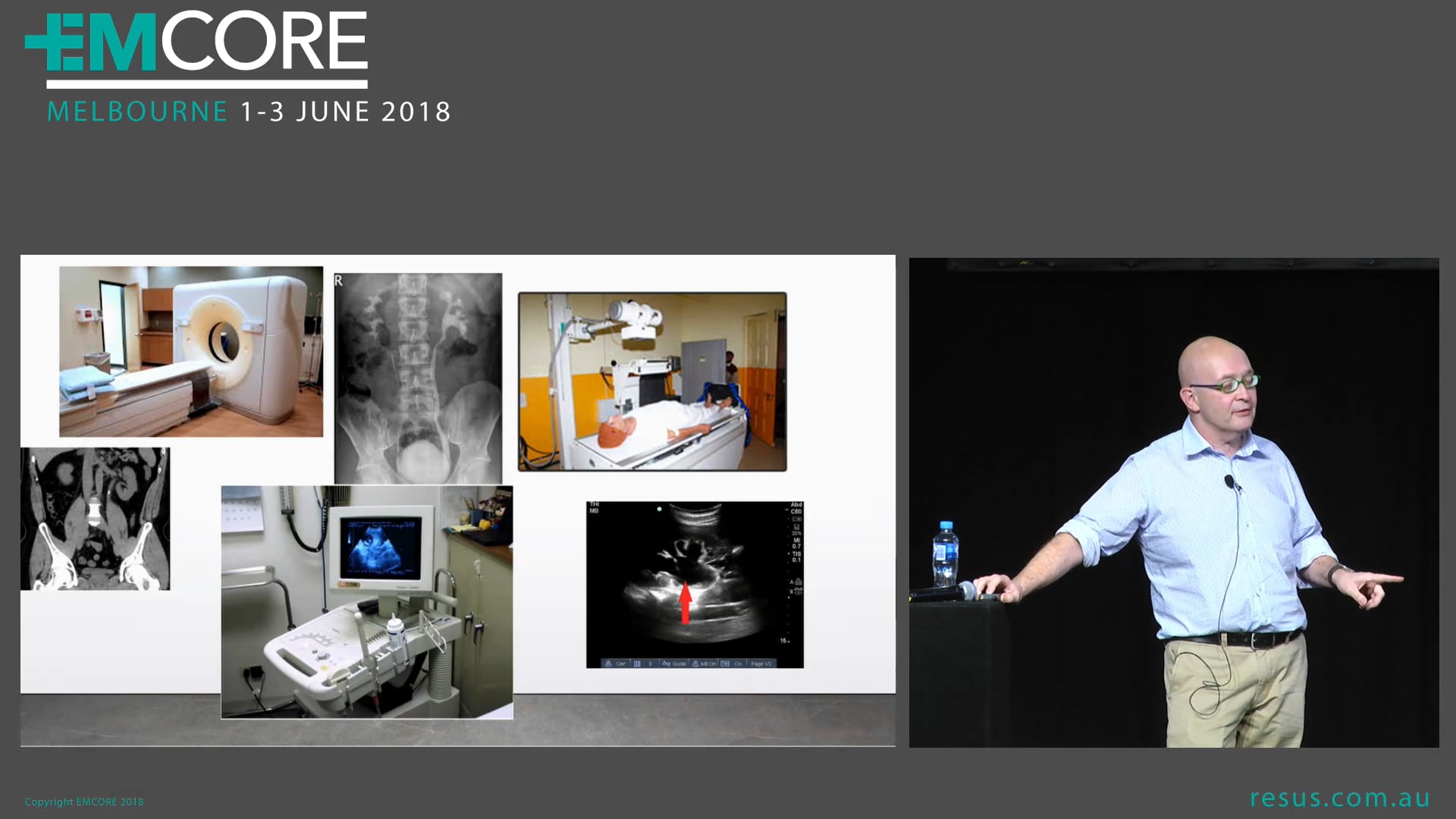 Nephrolithiasis Dr Gino Toncich