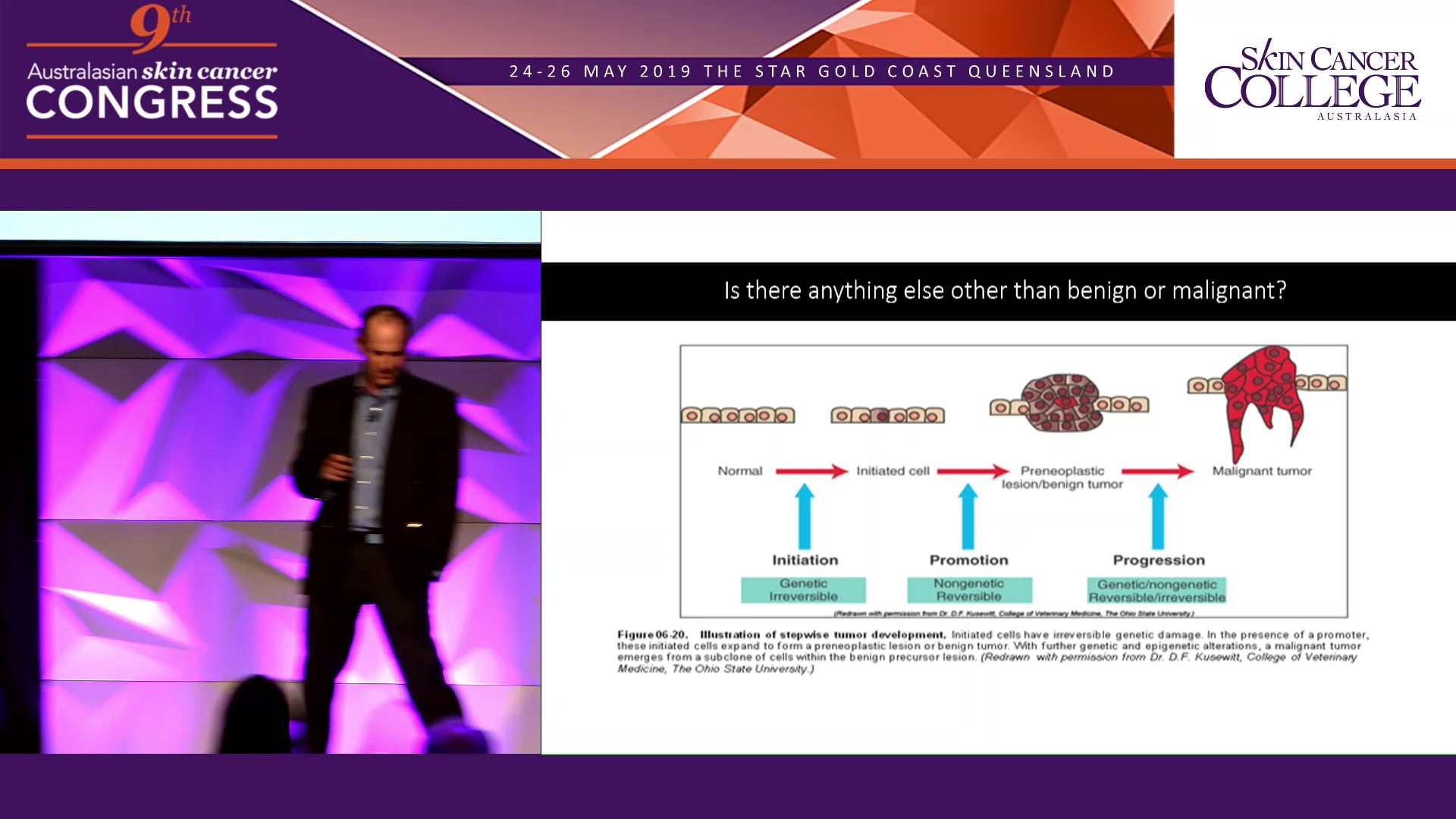 Borderline lesions or borderline pathologists Dr Ian Katz