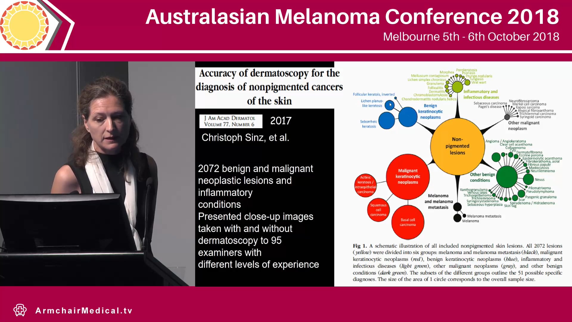 Diagnosis of amelanotic melanoma with dermoscopy Pascale Guitera